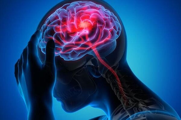 İnme Nöroloğundan Uyarı: 'Erken Müdahale İnmeyi Önler'