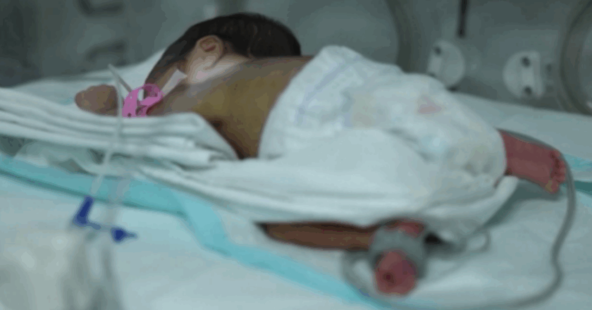 Türkiye’de 100 bebekten 13’ü prematüre doğuyor